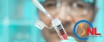 Thử nghiệm vắc xin chống HIV giai đoạn hai vào năm 2017