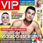 Cristiano Ronaldo nghiện làm đẹp bằng bơm botox